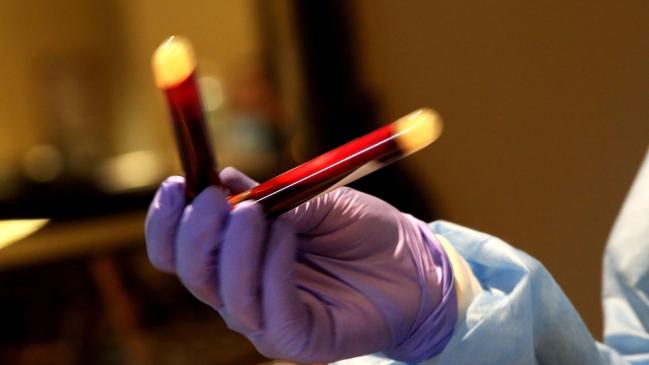 Coronavirus "vacunas", kits de prueba y PEE se venden en dark web