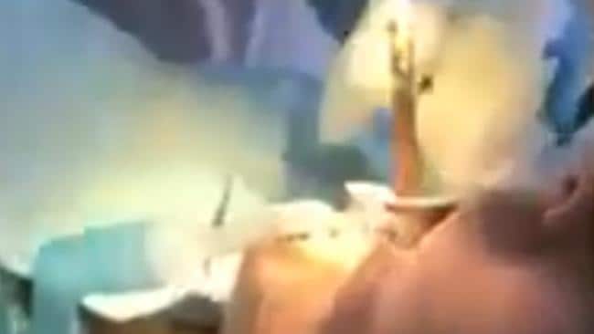 Médicos rusos sacan una serpiente de 1,2 metros de la boca de una mujer