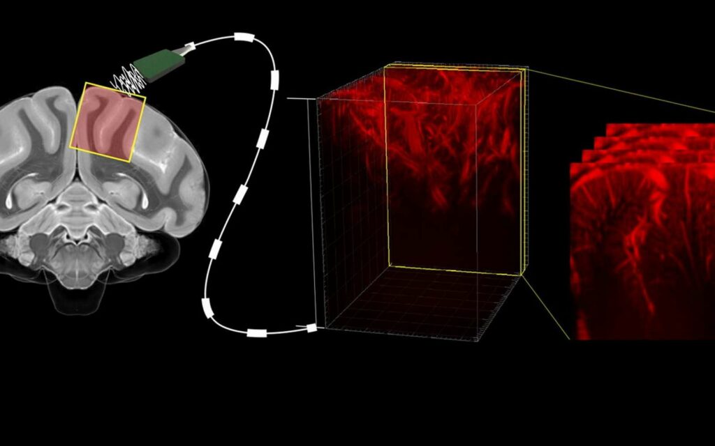 Des chercheurs sont parvenus à lire l’activité du cerveau grâce aux ultrasons. © Caltech