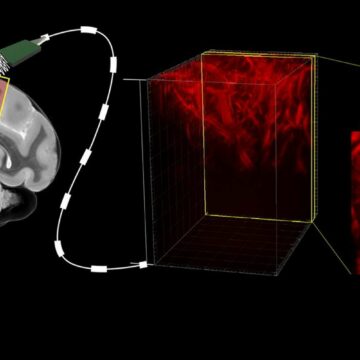 Des chercheurs sont parvenus à lire l’activité du cerveau grâce aux ultrasons. © Caltech