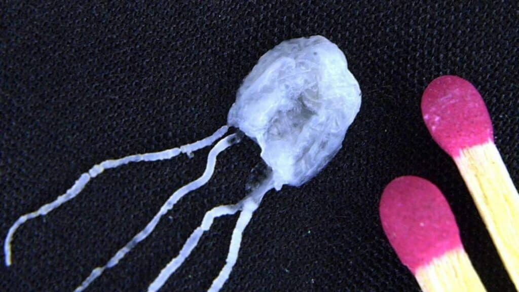 Picaduras de medusas: la afluencia de medusas mortales cierra las playas en el extremo norte de Queensland