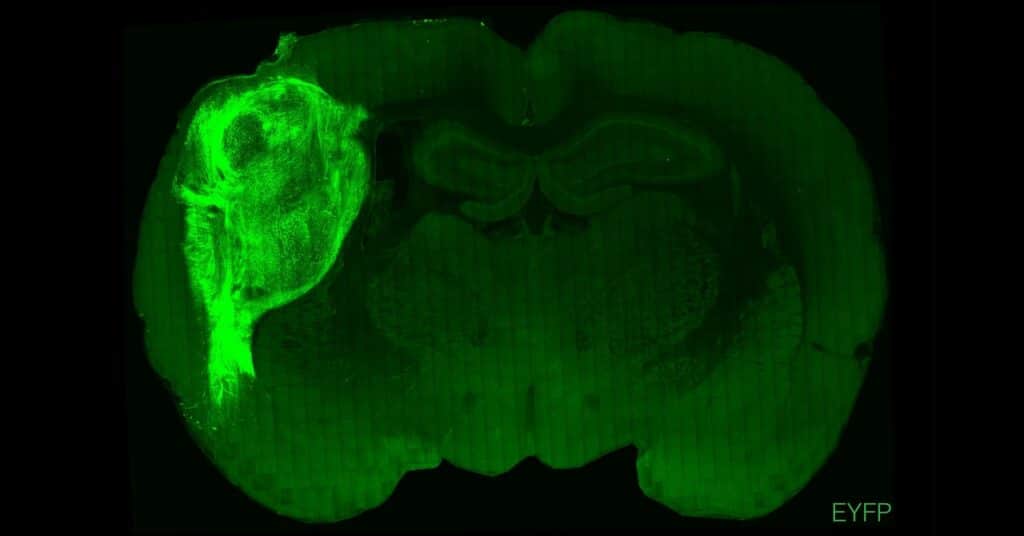 Tejido cerebral humano cultivado en laboratorio funciona en ratas