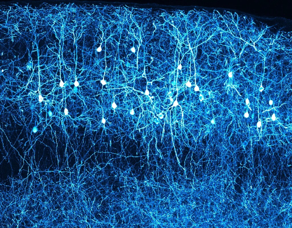 neuronas sobre fondo azul