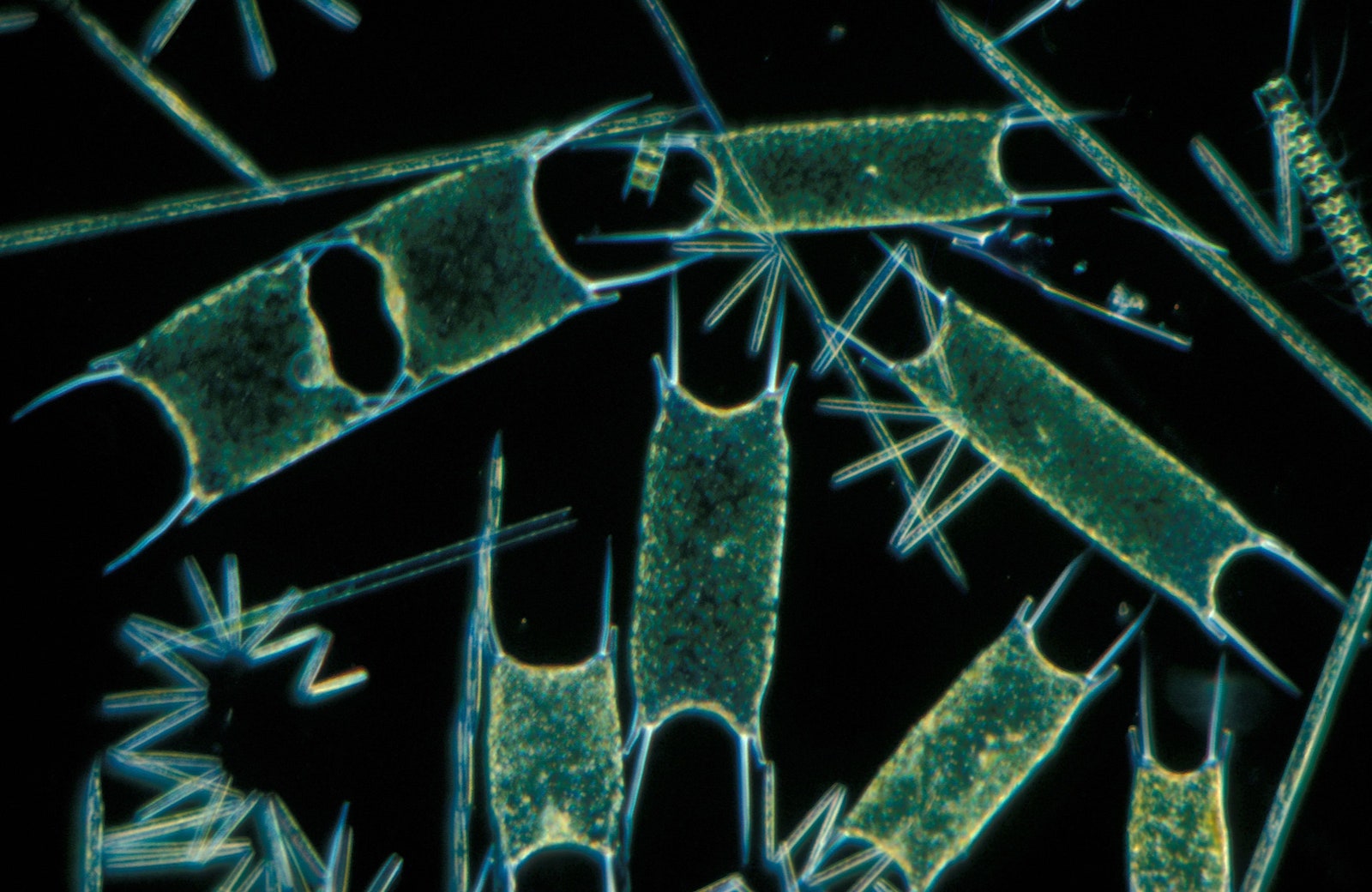 Fotografía microscópica de fitoplancton verde sobre fondo negro